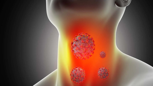 Cara Alami Mengatasi Radang Tenggorokan Secara Alami Agar Cepat Sembuh Tanpa Antibiotik